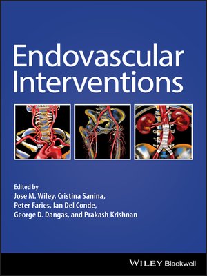 cover image of Endovascular Interventions